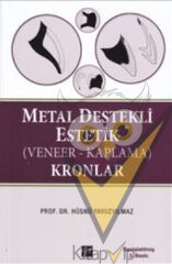 Metal Destekli Estetik (Veneer-Kaplama)Kronlar